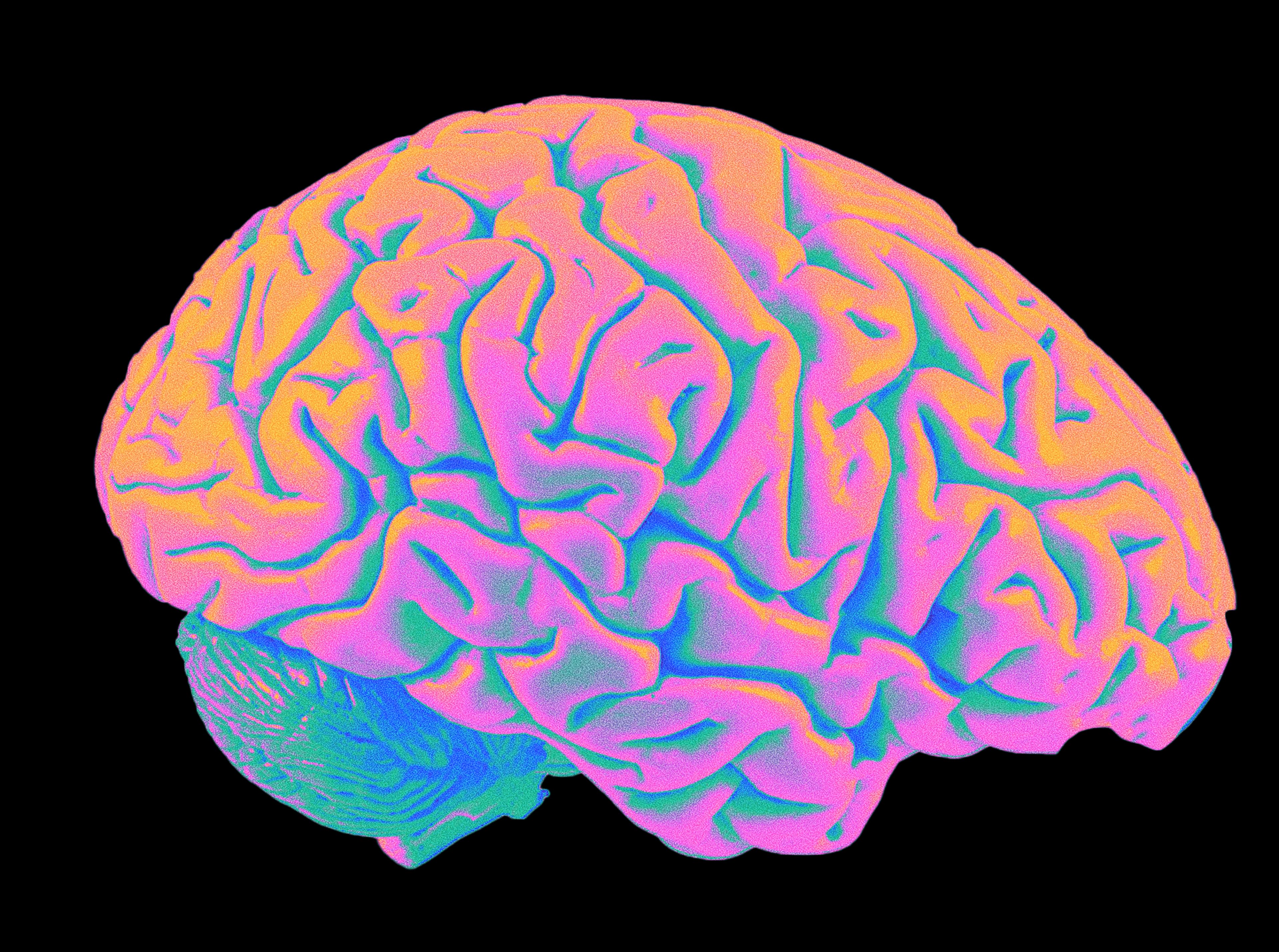 Tracer Brain - Advanced observability platform visualization